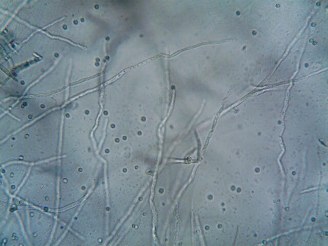 Nématodes ravageurs