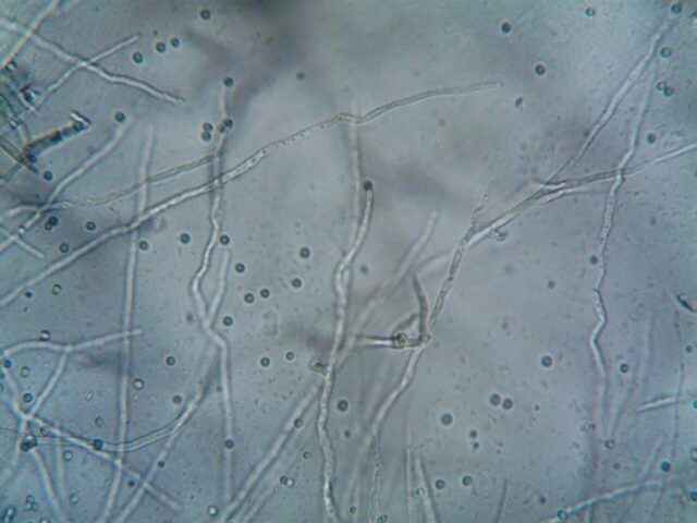 Nématodes ravageurs